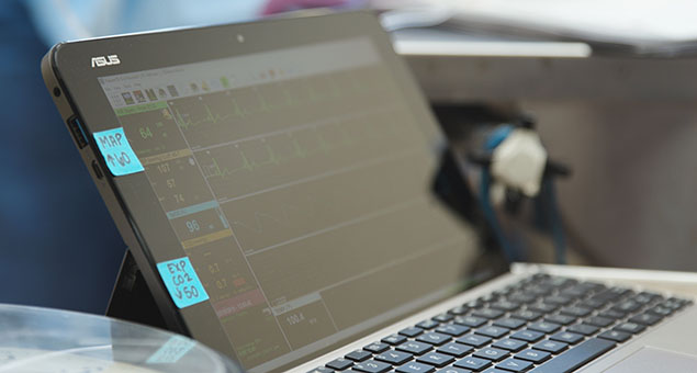 anesthesia monitor 2